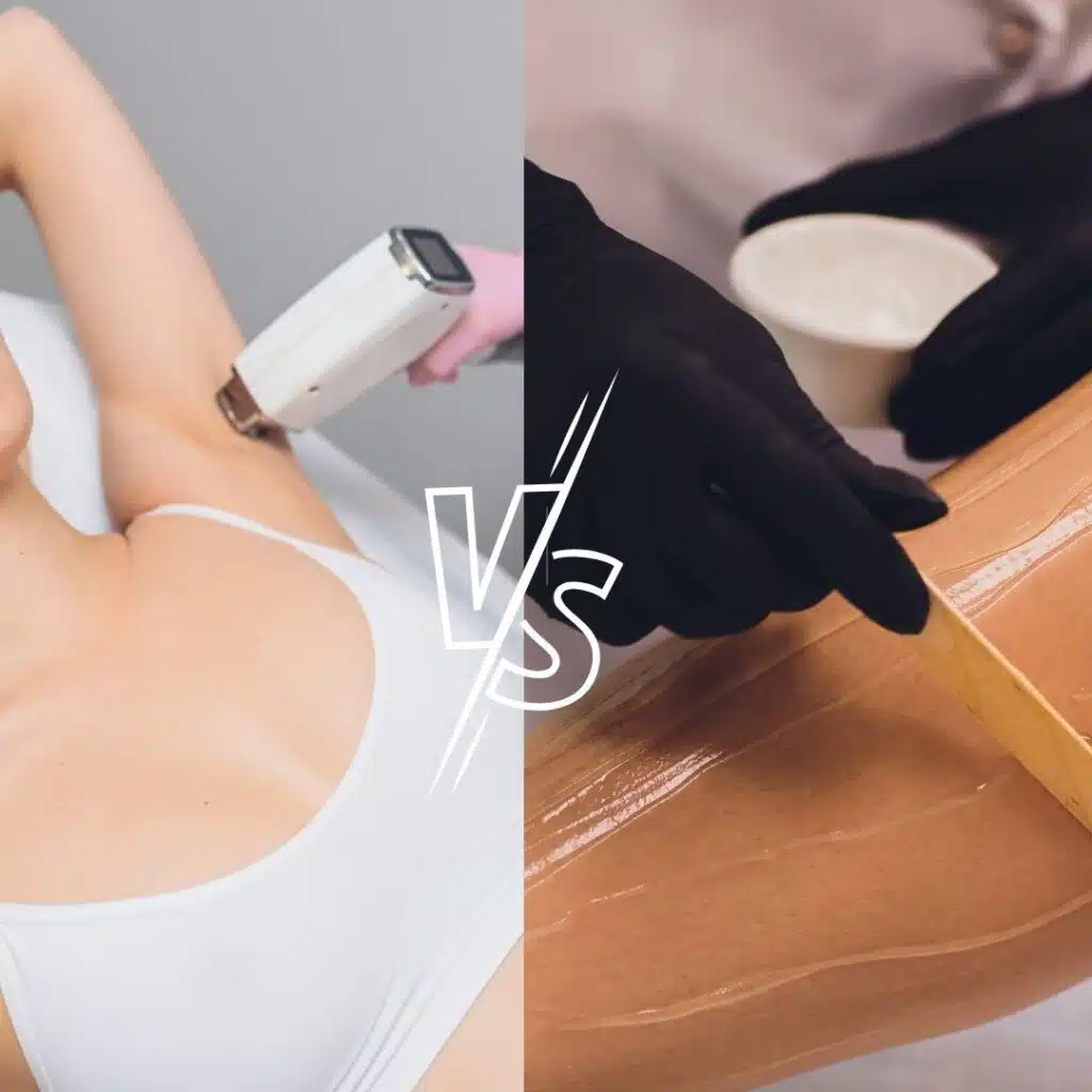Imagem comparativa,divida ao meio, com o símbolo de "versus" ao meio para mostrar uma imagem de depilação à laser de uma axila à esquerda e uma depilação com cera em uma perna à direita.